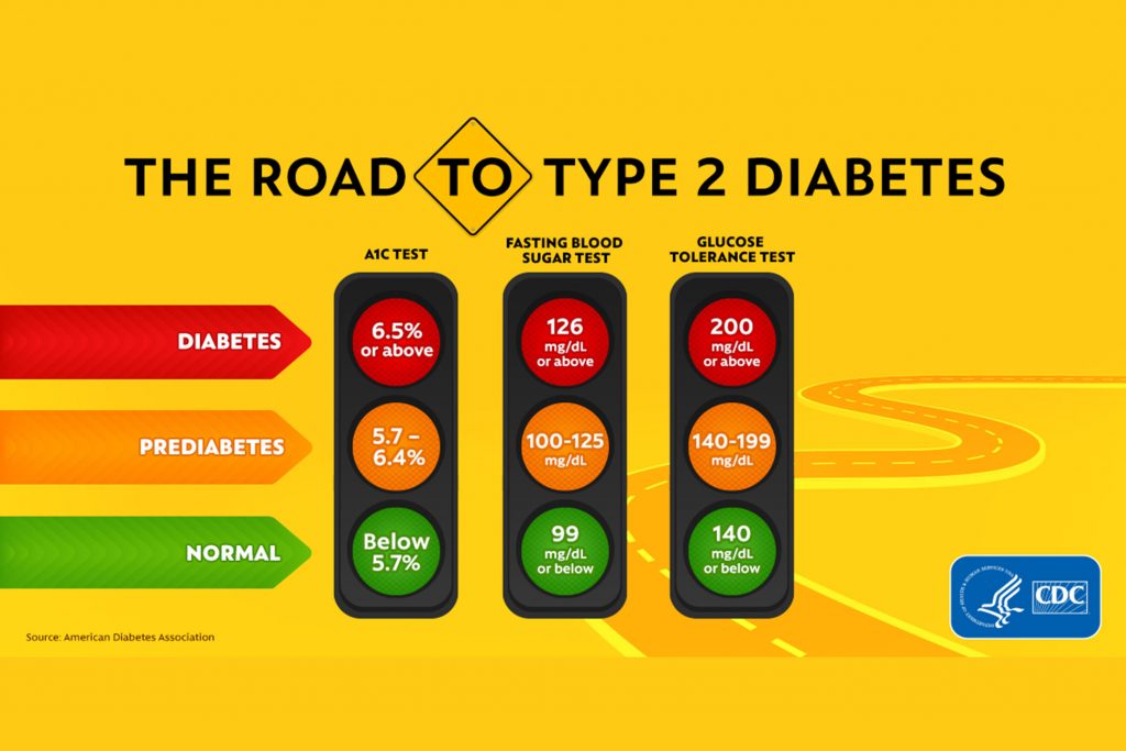 ad: the road to type 2 diabetes